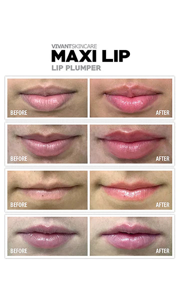 Maxilip Lip Plumper